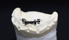 ΟΔΟΝΤΟΤΕΧΝΙΤΗΣ ΜΑΡΤΙΟΥ ΘΕΣΣΑΛΟΝΙΚΗ ΠΑΠΑΦΛΩΡΑΤΟΣ ΙΩΑΝΝΗΣ