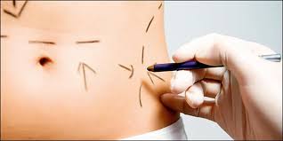 ΠΛΑΣΤΙΚΟΣ ΧΕΙΡΟΥΡΓΟΣ ΚΟΛΩΝΑΚΙ ΑΘΗΝΑ ΑΤΤΙΚΗ ΓΕΩΡΓΙΟΥ ΠΑΝΑΓΗΣ