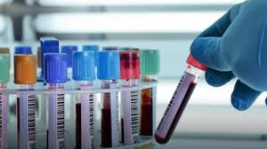 ΜΙΚΡΟΒΙΟΛΟΓΟΣ ΒΙΟΠΑΘΟΛΟΓΟΣ ΜΙΚΡΟΒΙΟΛΟΓΙΚΟ ΕΡΓΑΣΤΗΡΙΟ ΣΕΡΒΙΑ ΚΟΖΑΝΗ ΤΣΙΑΒΗ ΠΟΛΥΞΕΝΗ