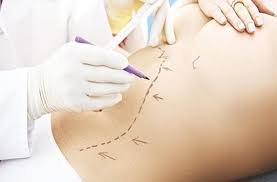 ΠΛΑΣΤΙΚΟΣ ΧΕΙΡΟΥΡΓΟΣ ΚΗΦΙΣΙΑ ΘΕΣΣΑΛΟΝΙΚΗ ΣΑΜΑΡΑΣ ΝΙΚΟΛΑΟΣ