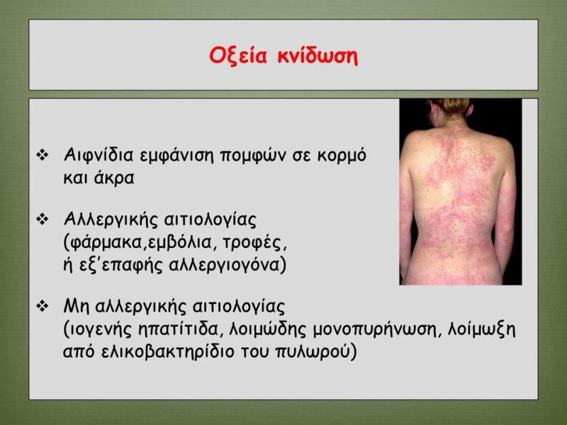 ΔΕΡΜΑΤΟΛΟΓΟΣ ΑΦΡΟΔΙΣΙΟΛΟΓΟΣ ΘΕΣΣΑΛΟΝΙΚΗ ΠΑΤΣΑΤΣΗ ΑΙΚΑΤΕΡΙΝΗ