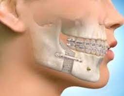 ΓΝΑΘΟΧΕΙΡΟΥΡΓΟΣ ΠΑΛΛΗΝΗ ΑΤΤΙΚΗ ΒΑΣΙΛΕΙΟΥ ΣΤΑΥΡΟΣ